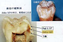 LSTR３Mix-MP療法 LSTR ３Mix-MP療法　歯科総合出版社　歯科 LSTR 3Mix-MP療法| 歯科総合出版社 デンタルダイヤモンド社